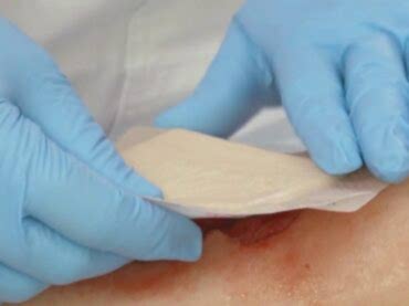 Evde Yara, Dekübit Bakımı ve Pansuman