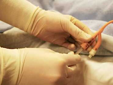 Evde Sonda Takma Hizmeti